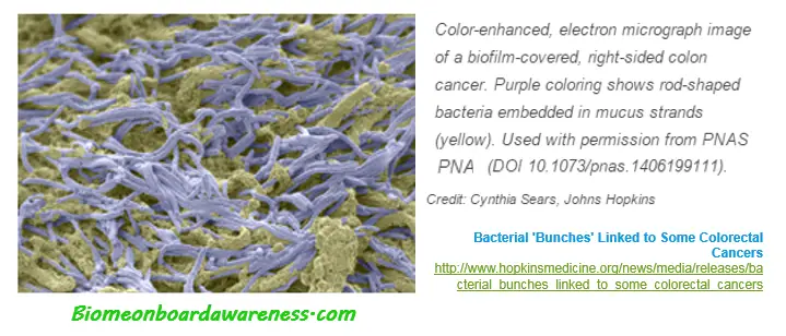 Colon Cancer, Biofilm, Bacteria, Probiotics Role » BIOME ONBOARD ...