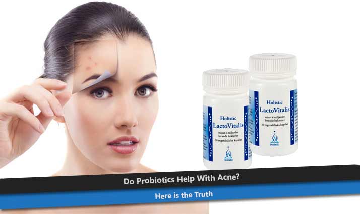 Do Probiotics Help With Acne? Here is The Truth