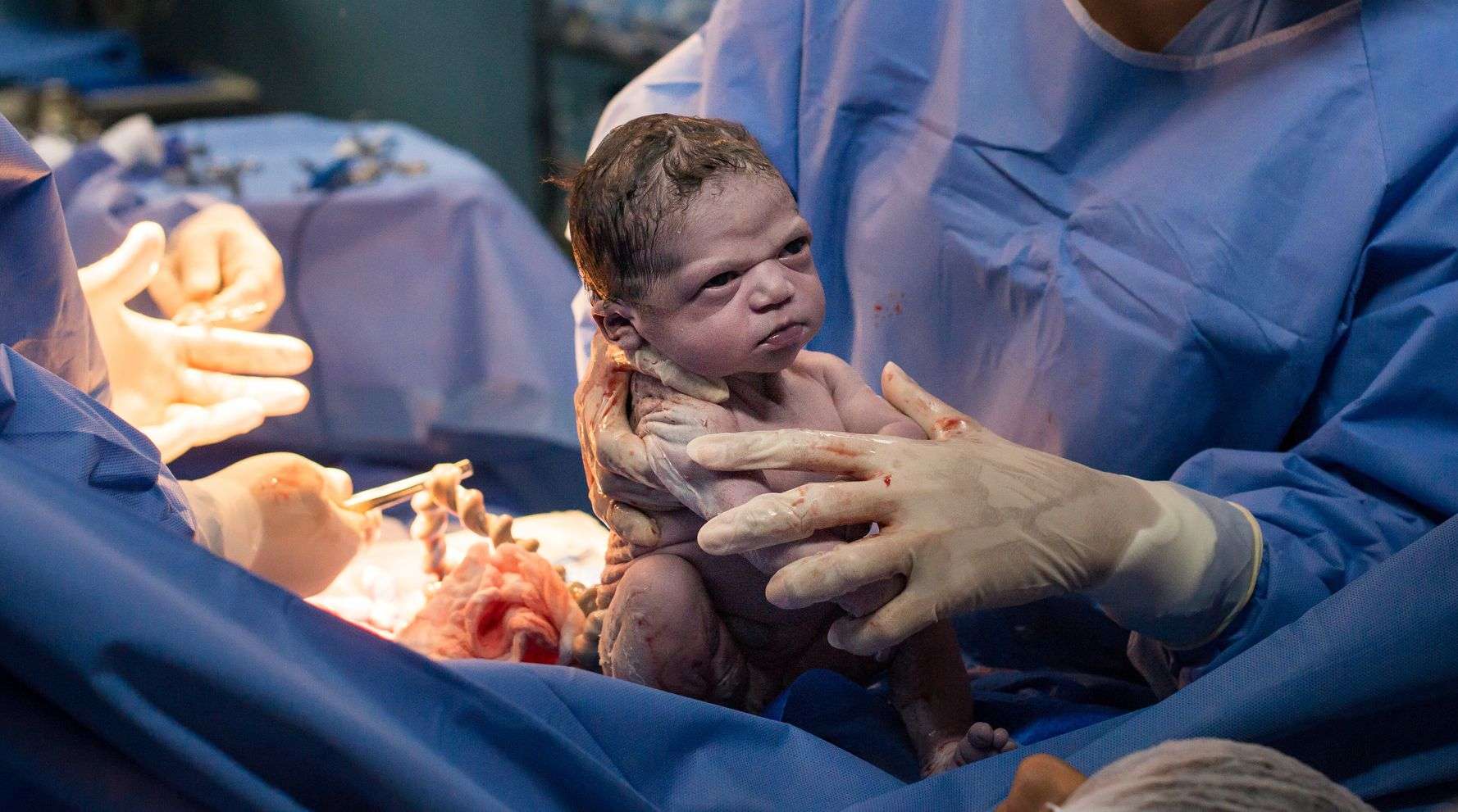 Newborn Makes an Epic Face in a Birth Photo that Went ...