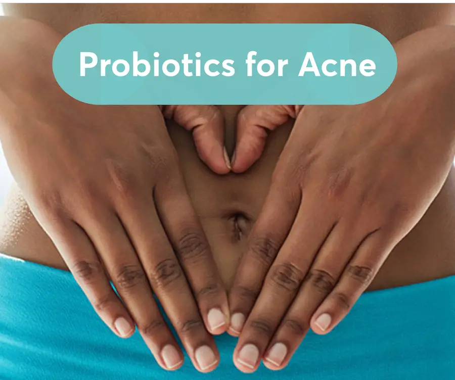 Should you take probiotics for acne?